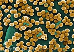 Rapid detection of superbugs