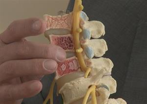 Back Pain: New Tools for Prevention